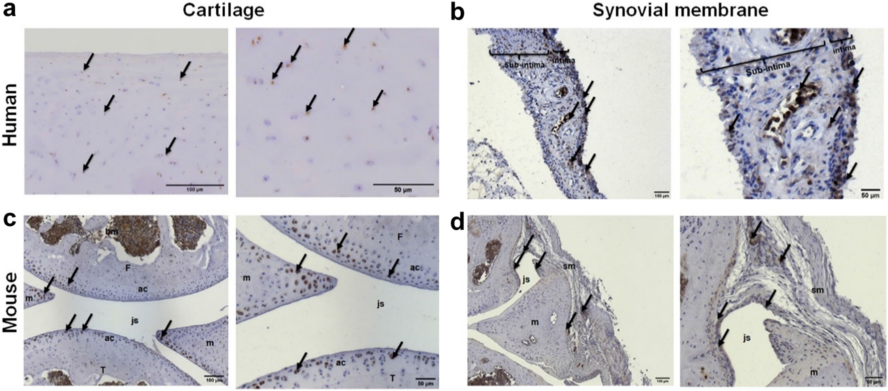 allergic reaction to retatrutide Tirzepatide-Induced Injection Site Reaction allergic reaction to retatrutide Tirzepatide-Induced Injection Site Reaction
