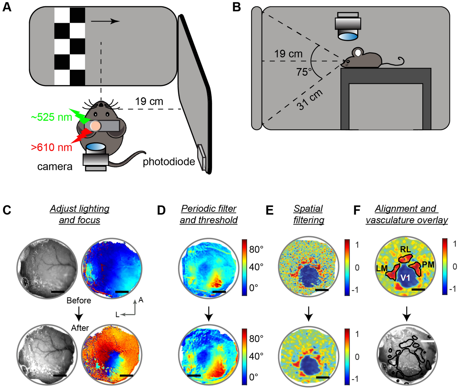 Figure 1 from Brain surface temperature under a craniotomy.