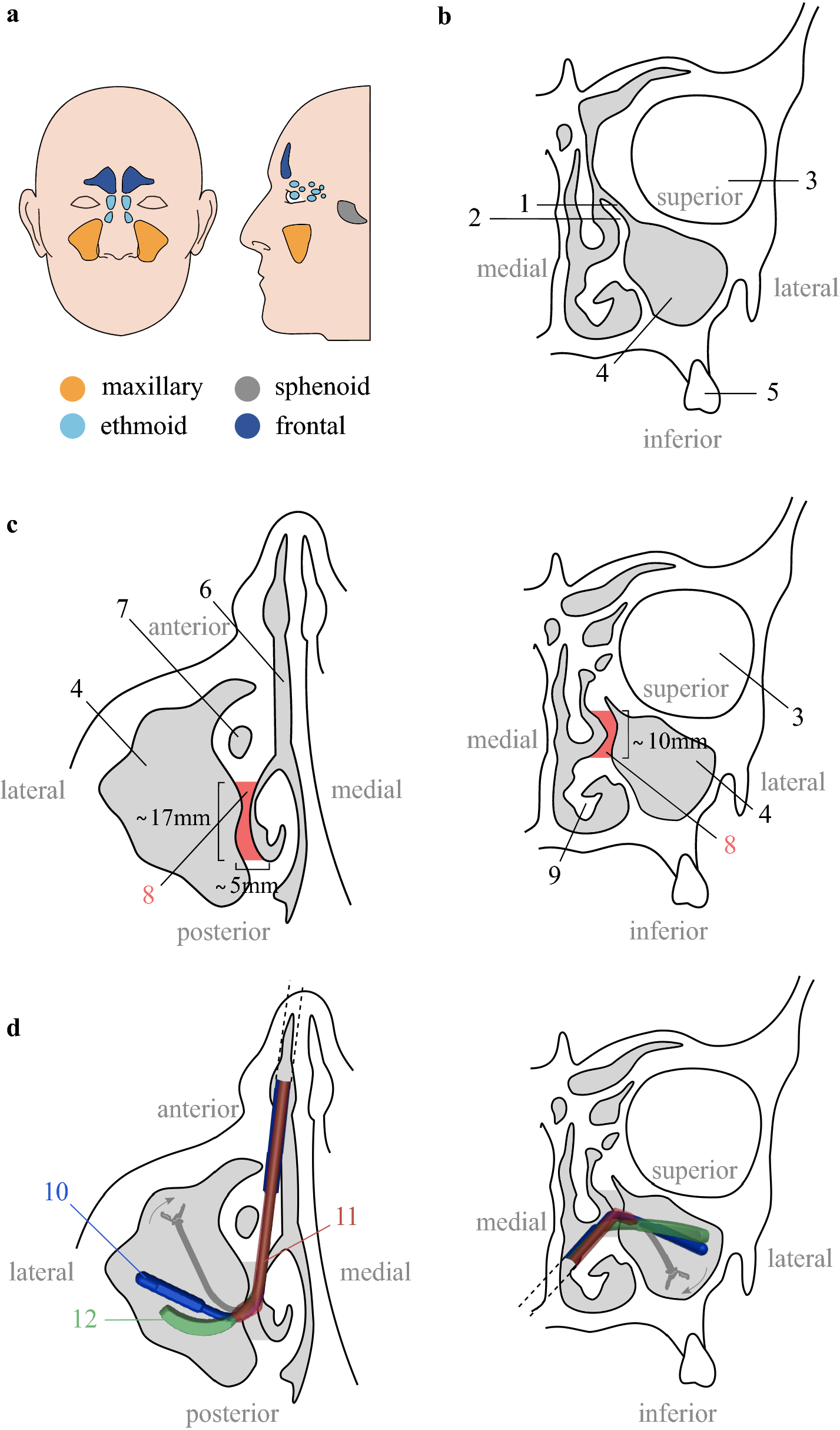 The Paranasal Sinuses - Structure - Function - TeachMeAnatomy