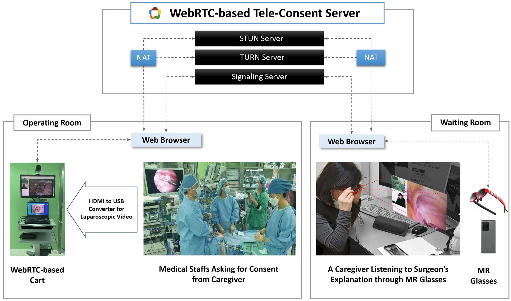 Tele Consent Using Mixed Reality Glasses Nreal In Pediatric Inguinal Herniorrhaphy A Preliminary Study Scientific Reports