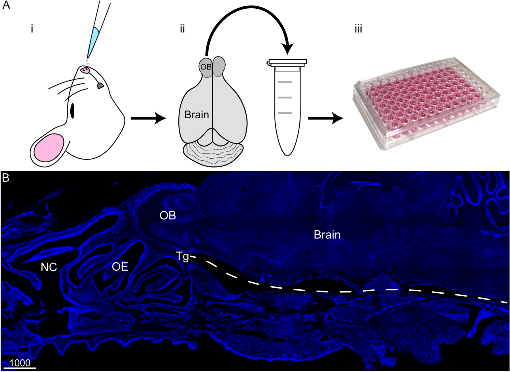 chlamydia pneumoniae glutathione  an infectious risk factor for atherosclerosis? The Chlamydia pneumoniae effector SemD