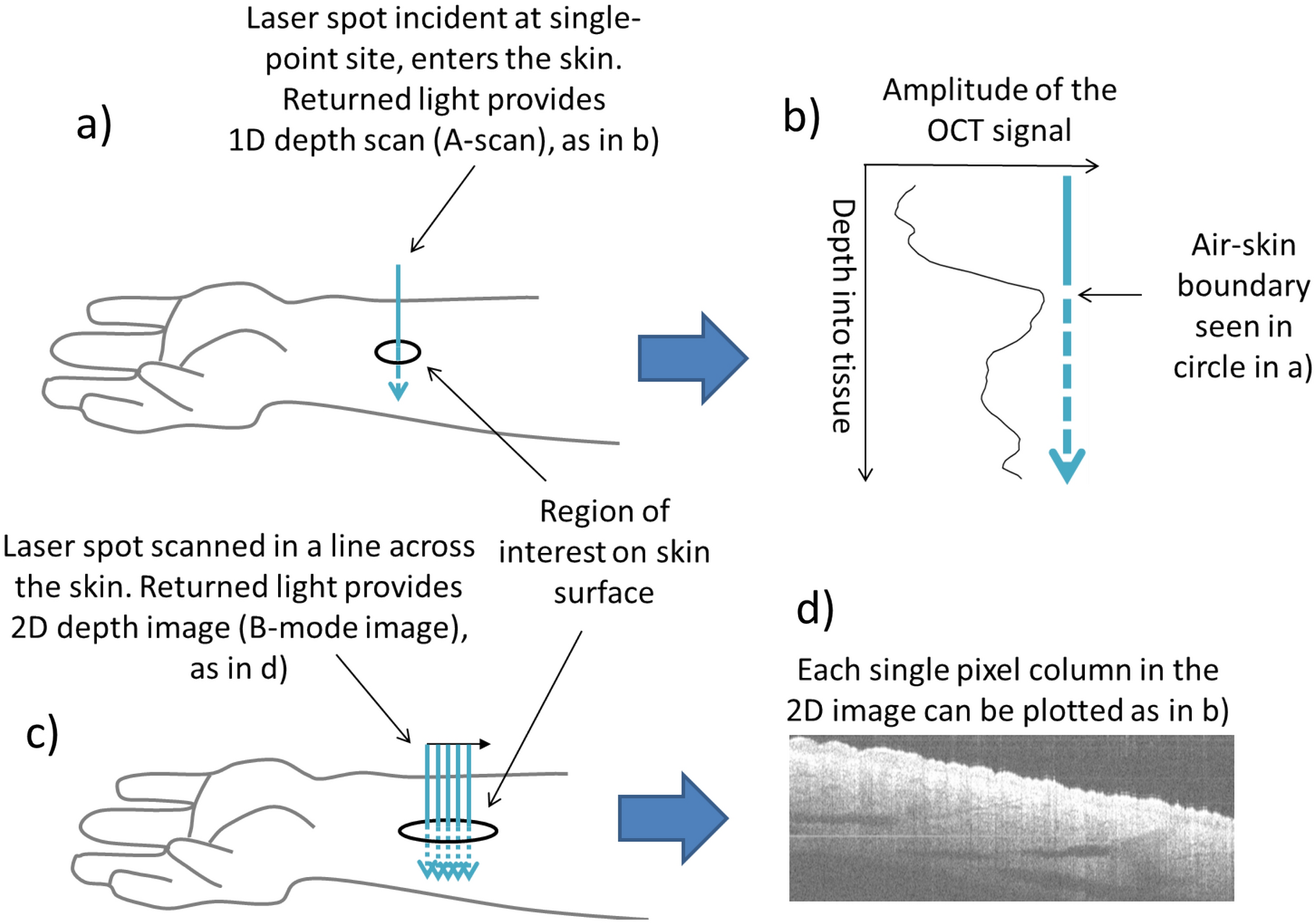 Polarisation-sensitive optical coherence tomography measurement of  retardance in fibrosis, a non-invasive biomarker in patients with systemic  sclerosis | Scientific Reports