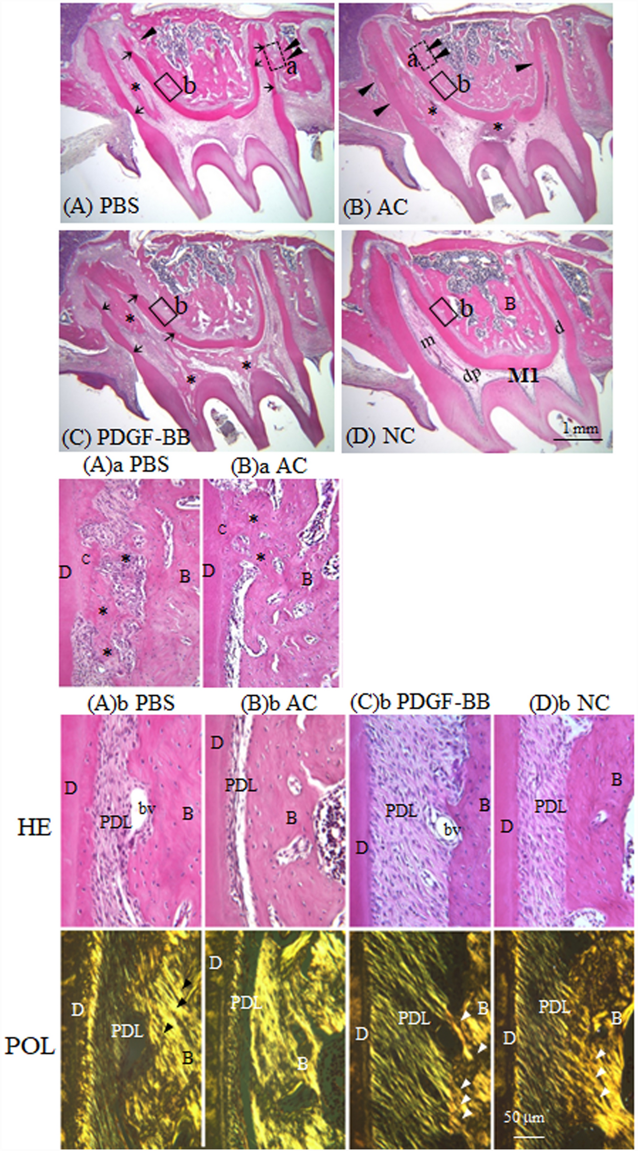 Platelet-derived growth factor-BB regenerates functional periodontal  ligament in the tooth replantation | Scientific Reports