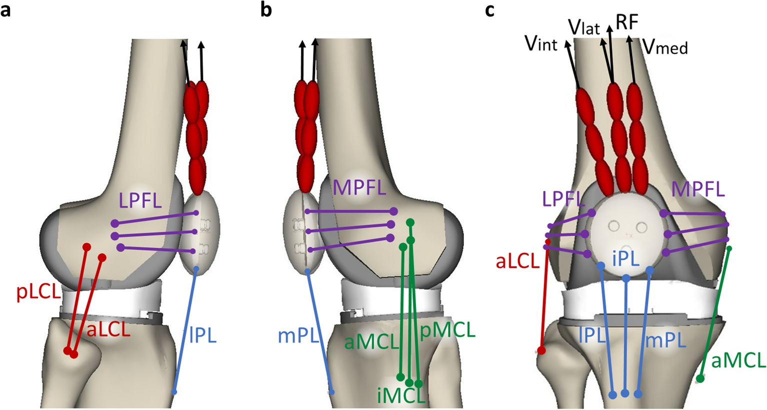 knee joint replacement devices