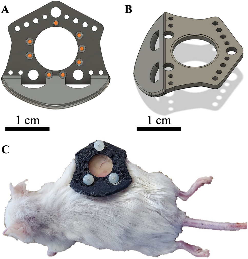 Bridging the macro to micro resolution gap with angiographic optical  coherence tomography and dynamic contrast enhanced MRI | Scientific Reports, image size:968x1010