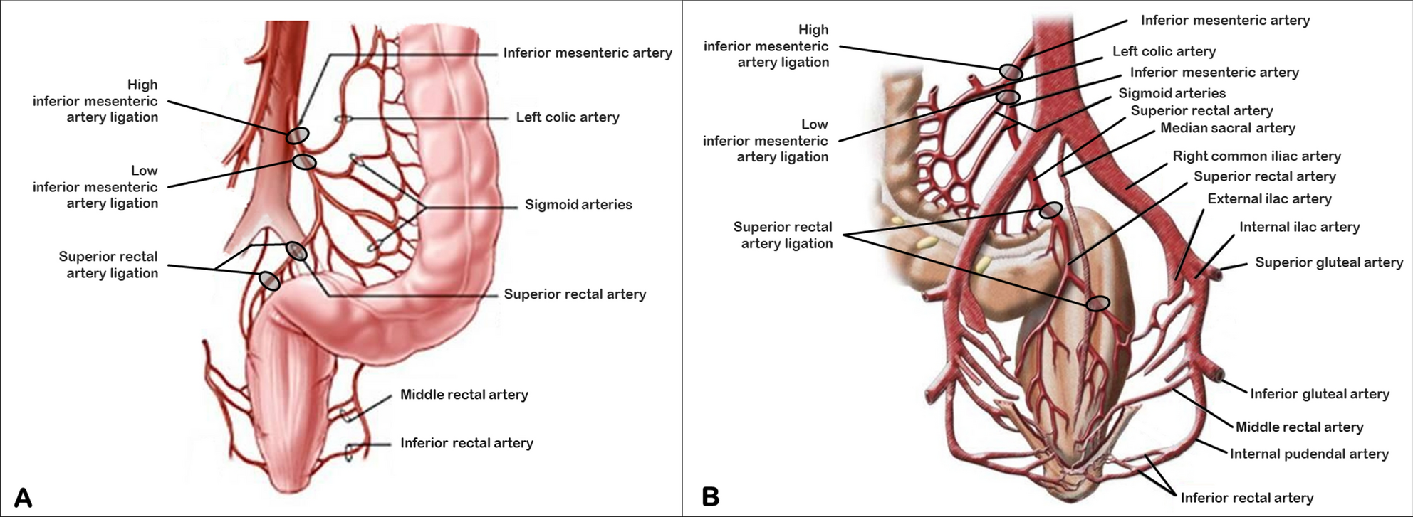 inferior mesenteric artery