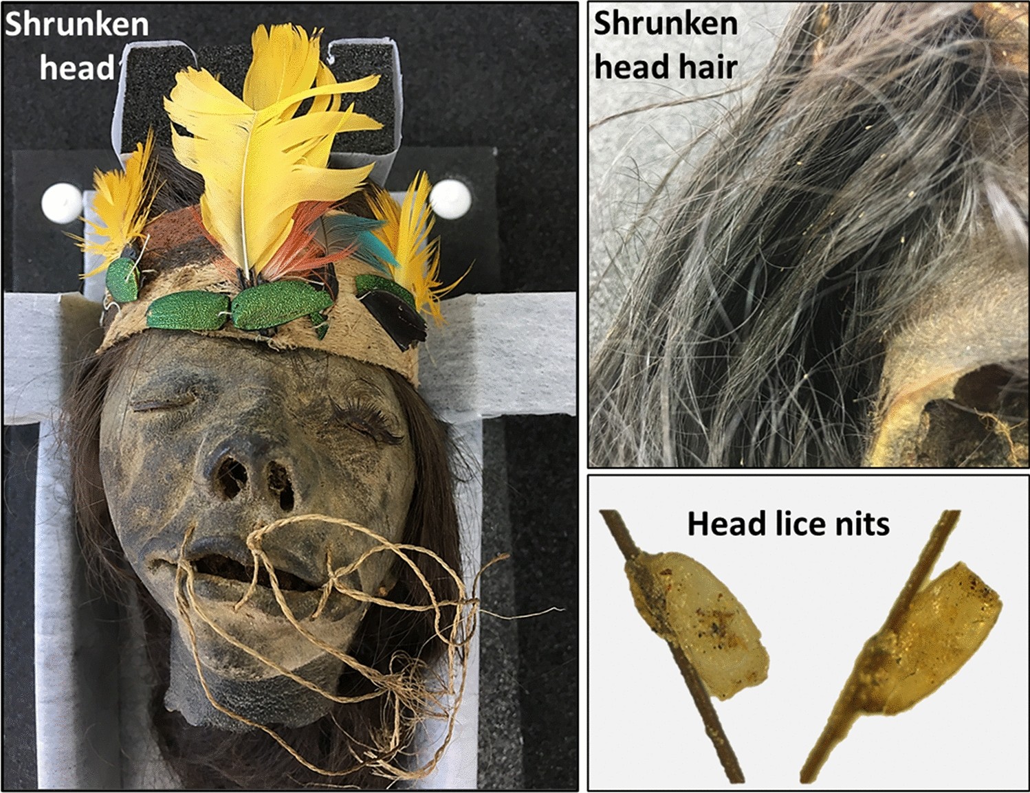Putative native South Amerindian origin of head lice clade F: evidence from  head lice nits infesting human shrunken heads | Scientific Reports