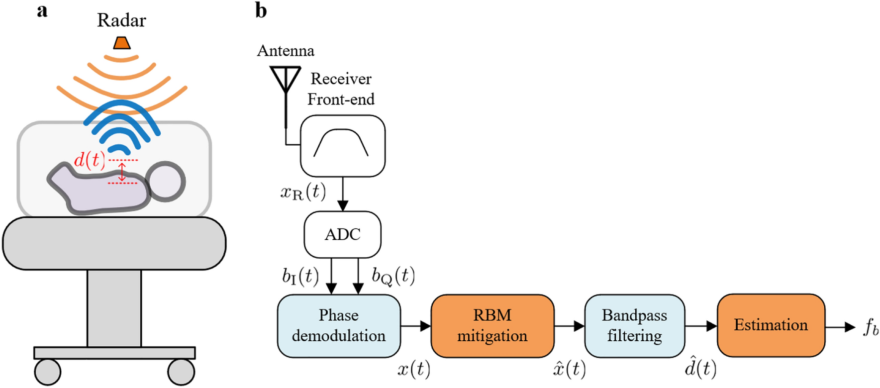 Contactless radar-based breathing monitoring of premature infants in the  neonatal intensive care unit | Scientific Reports