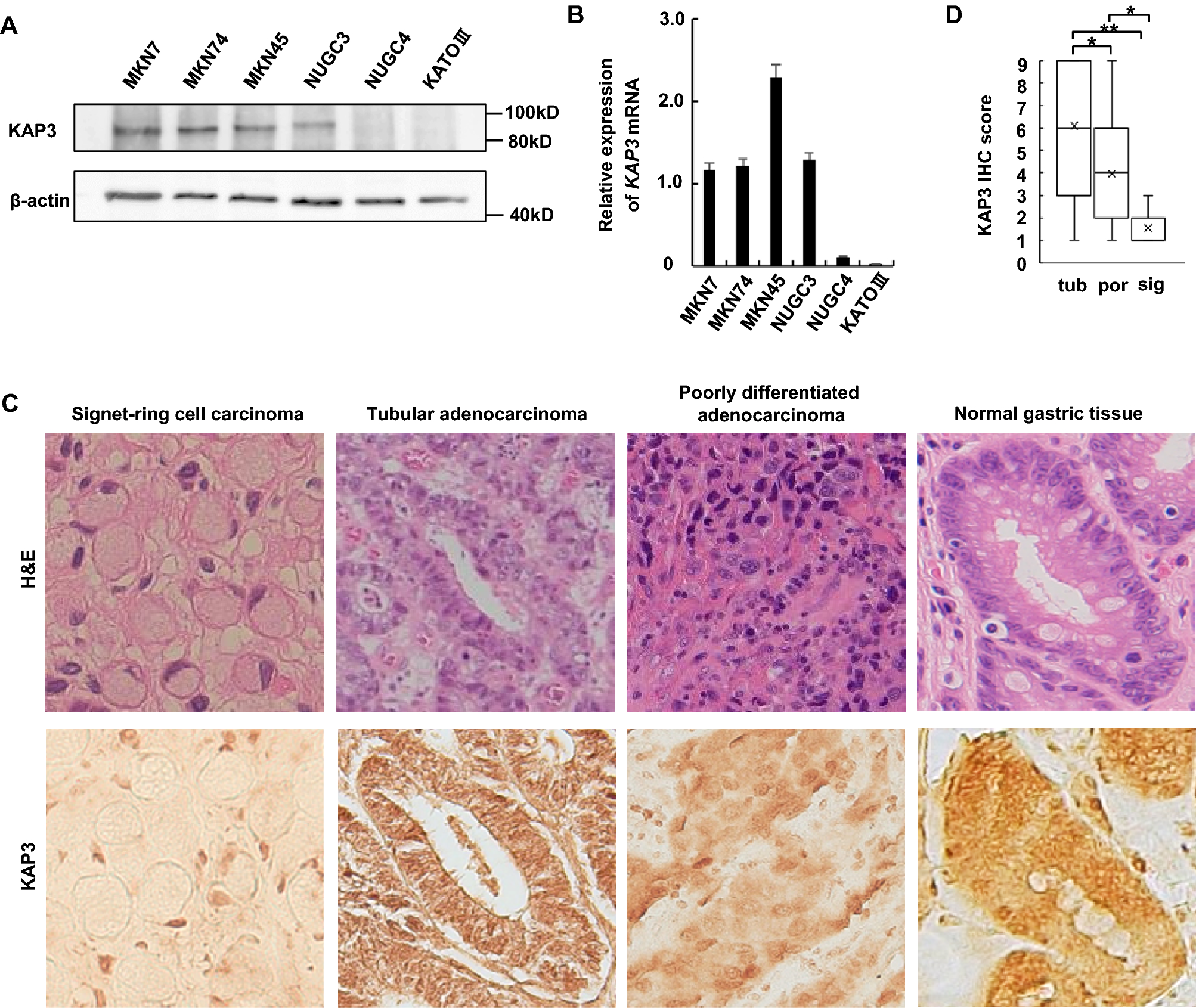 Loss of KAP3 decreases intercellular adhesion and impairs intracellular  transport of laminin in signet ring cell carcinoma of the stomach |  Scientific Reports