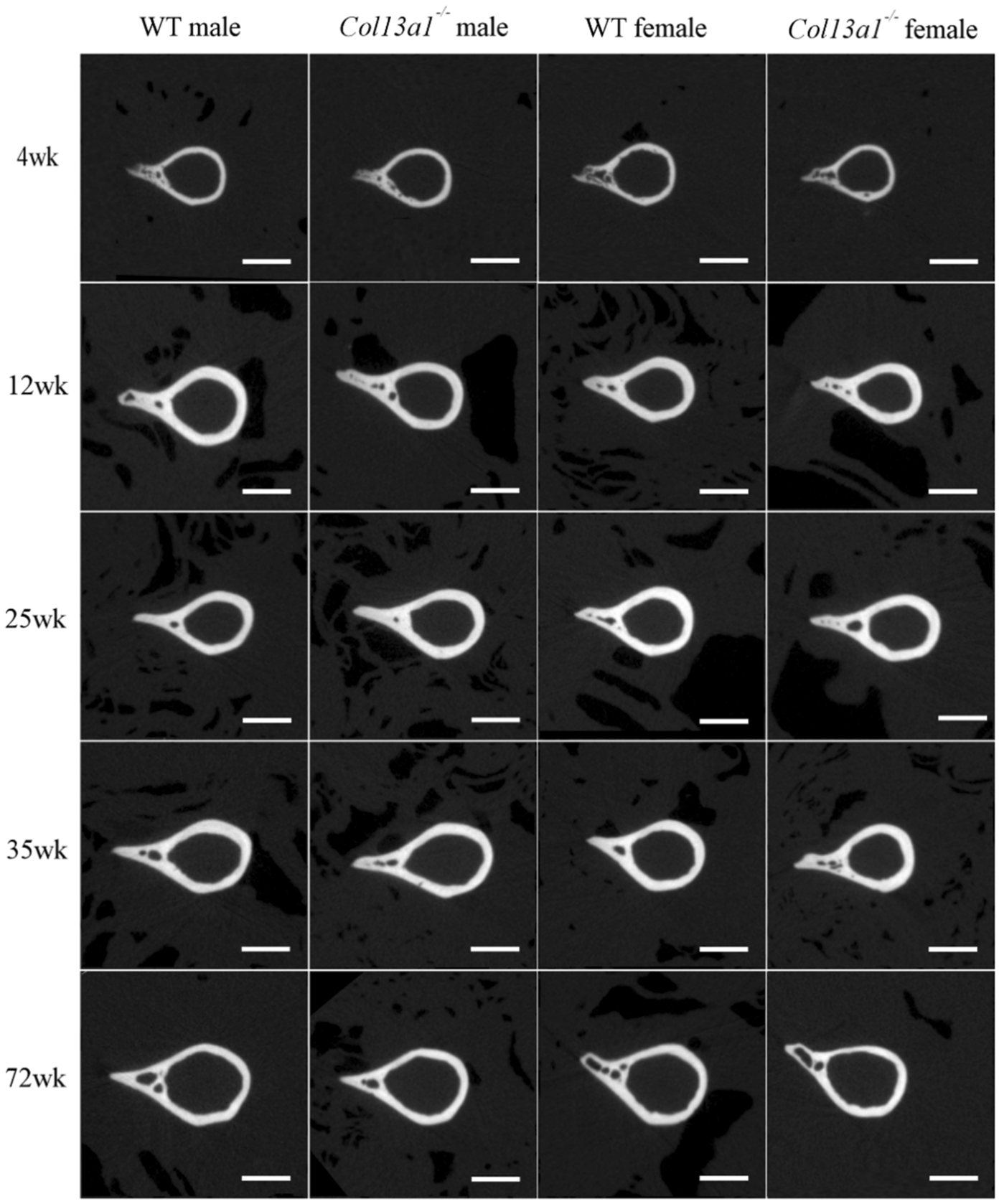 The CMS19 disease model specifies a pivotal role for collagen XIII in bone  homeostasis | Scientific Reports