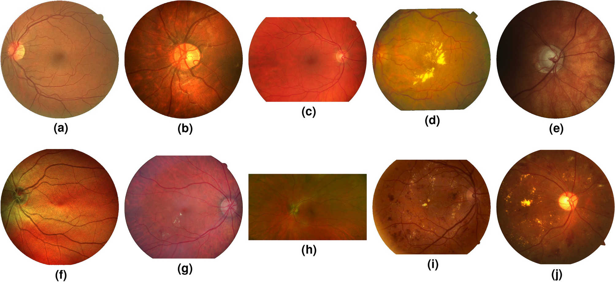 State-of-the-art retinal vessel segmentation with minimalistic models |  Scientific Reports