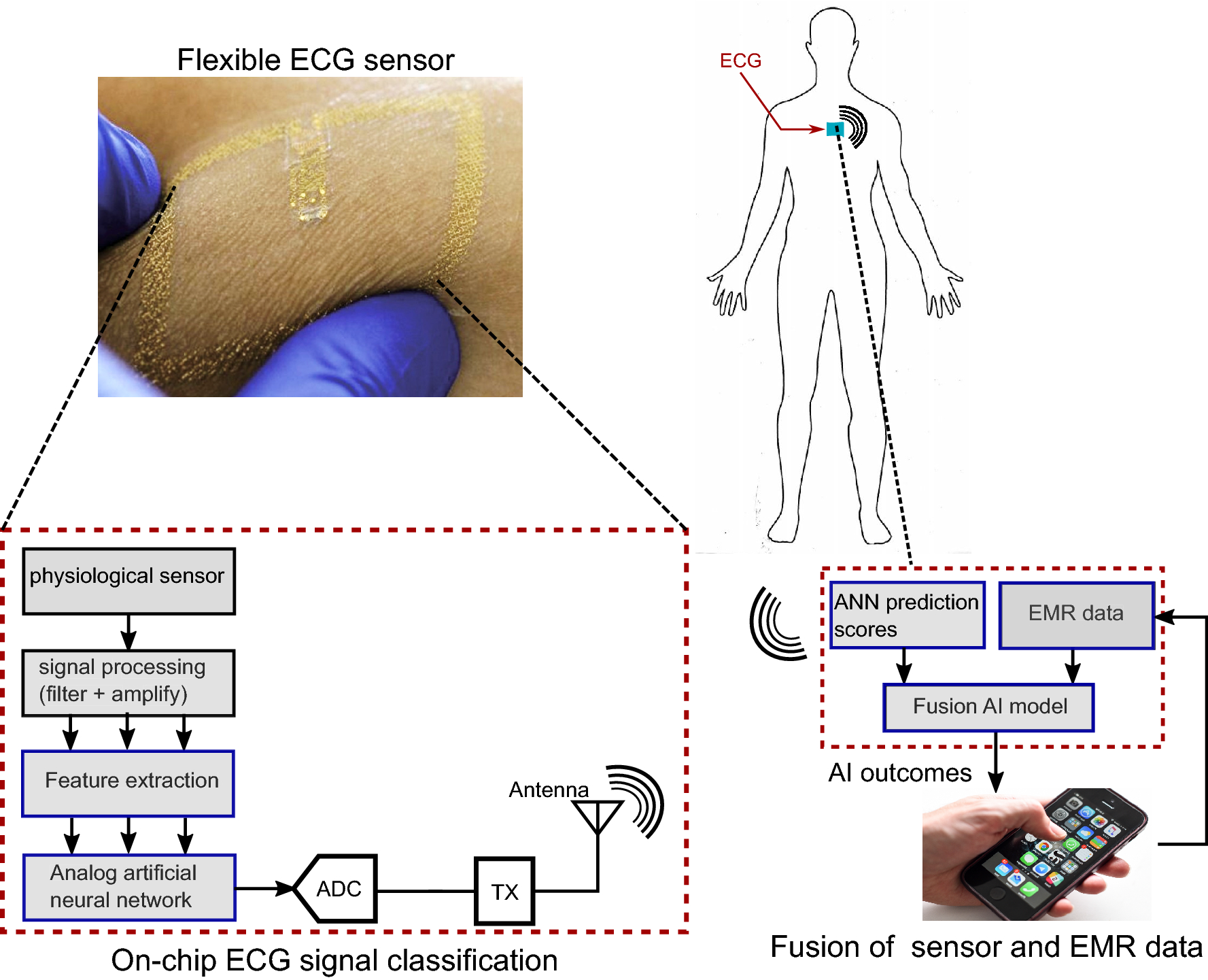 Fusion Of Fully Integrated Analog Machine Learning Classifier With Electronic Medical Records For Real Time Prediction Of Sepsis Onset Scientific Reports