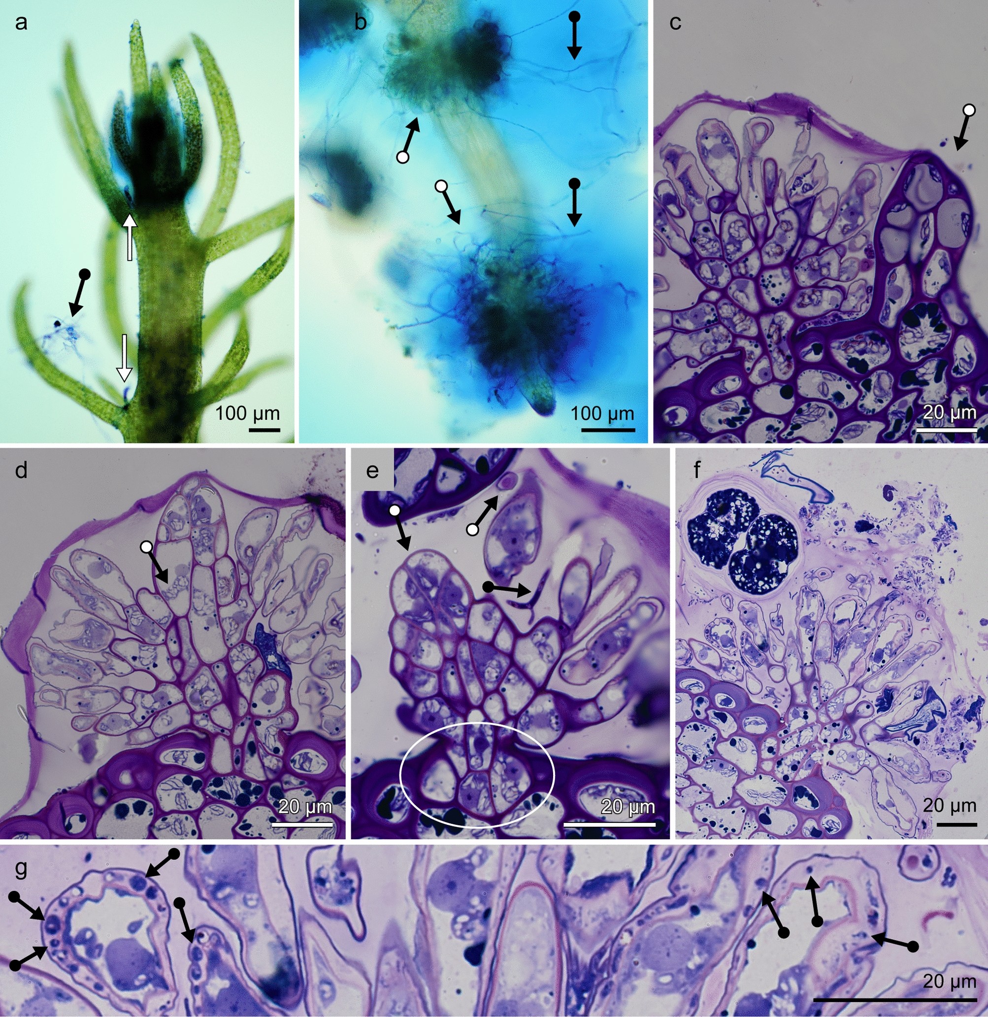 Microbiome And Related Structural Features Of Earth S Most Archaic Plant Indicate Early Plant Symbiosis Attributes Scientific Reports