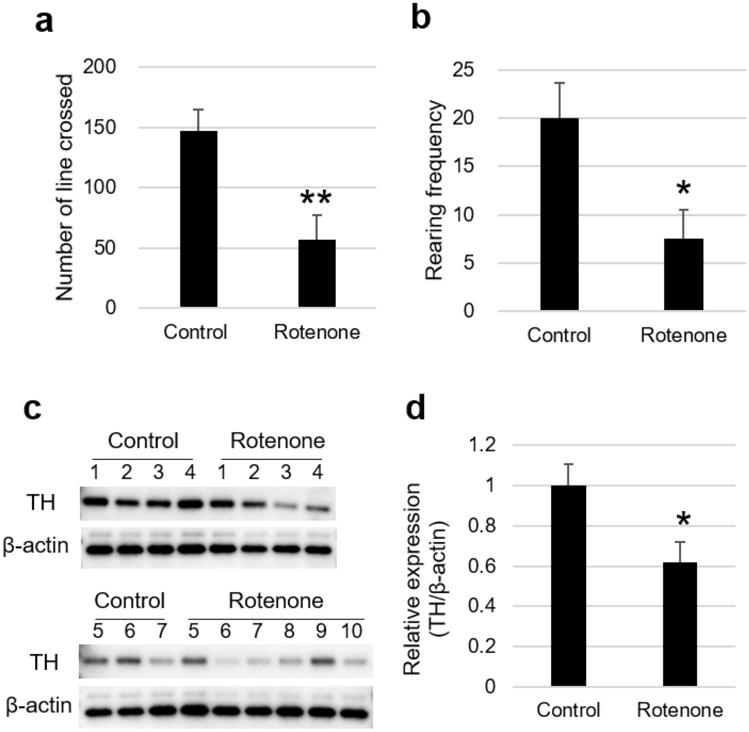 Diagnosis of Parkinson's disease by investigating the inhibitory effect of  serum components on P450 inhibition assay | Scientific Reports