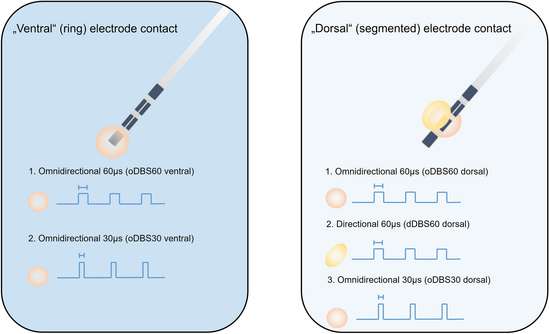 Short pulse and directional thalamic deep brain stimulation have  differential effects in parkinsonian and essential tremor | Scientific  Reports