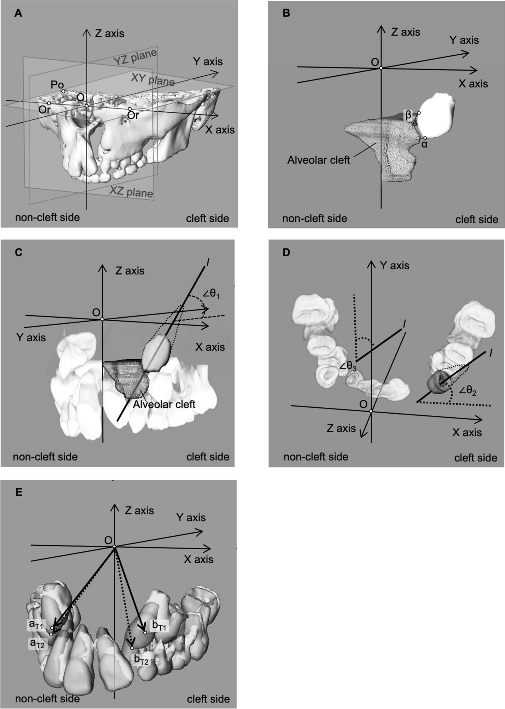 PDF) Mesiodistal angulation of the lateral teeth to the functional occlusal  plane in normal occlusions