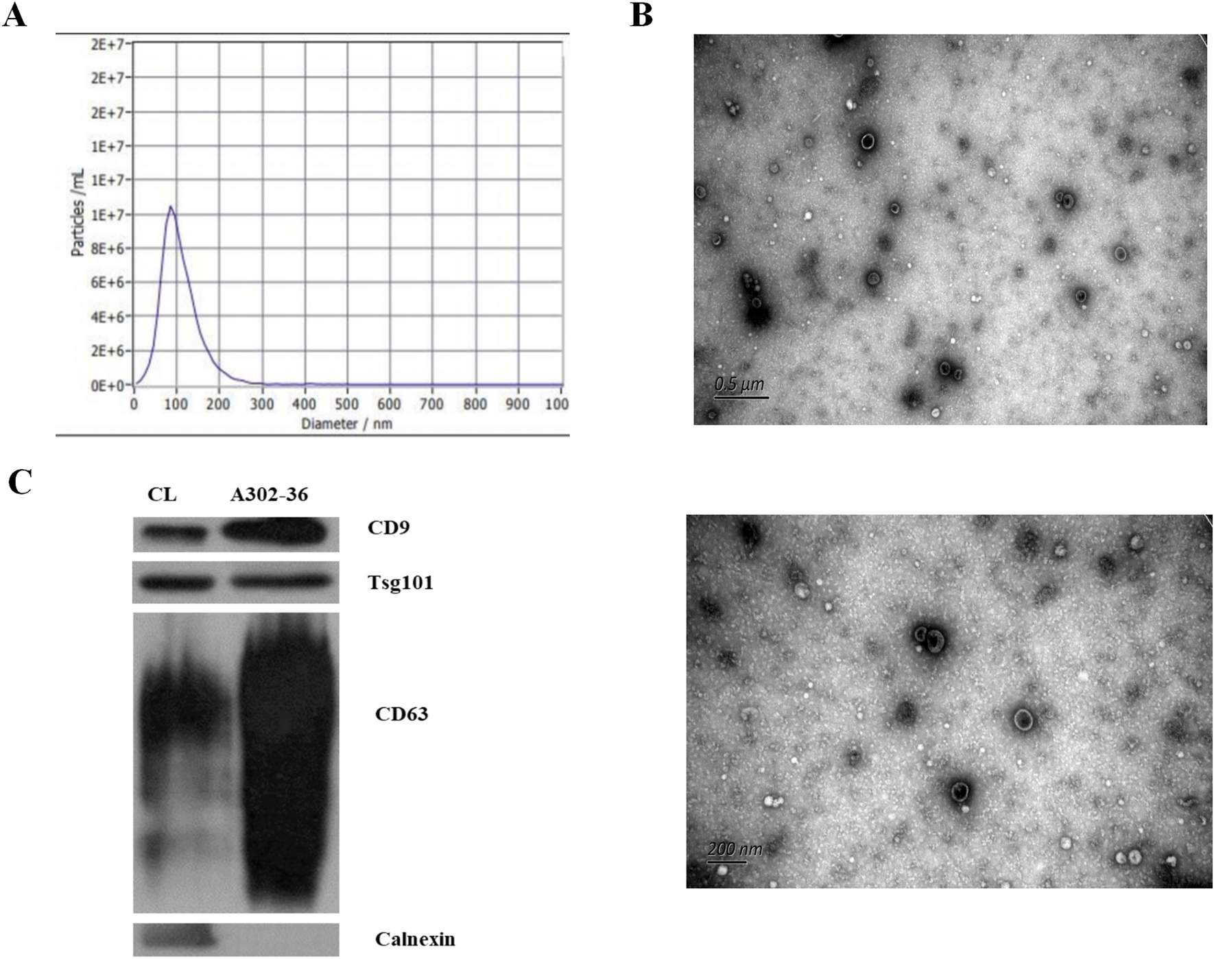 Differential proteomic analysis of plasma-derived exosomes as diagnostic  biomarkers for chronic HBV-related liver disease | Scientific Reports