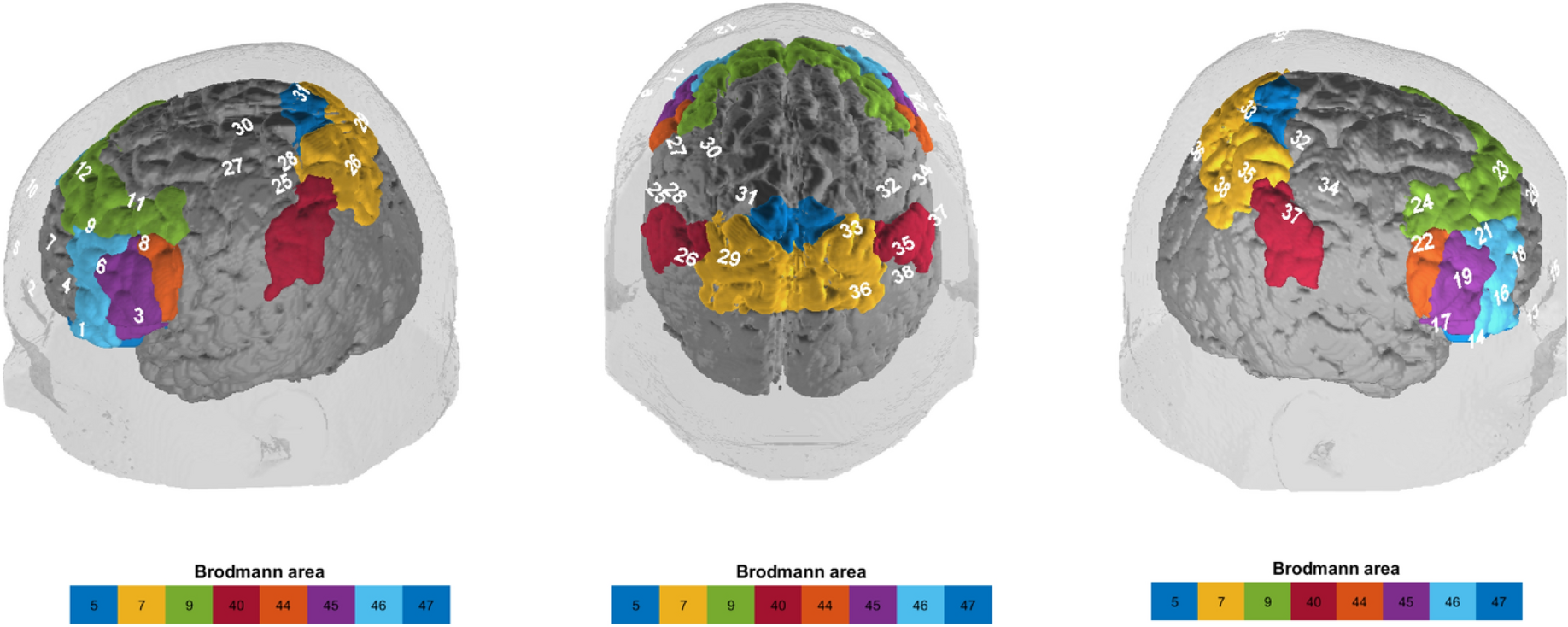 Effects of aging on functional connectivity in a neurodegenerative