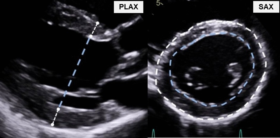 Echocardiography online normal values tables