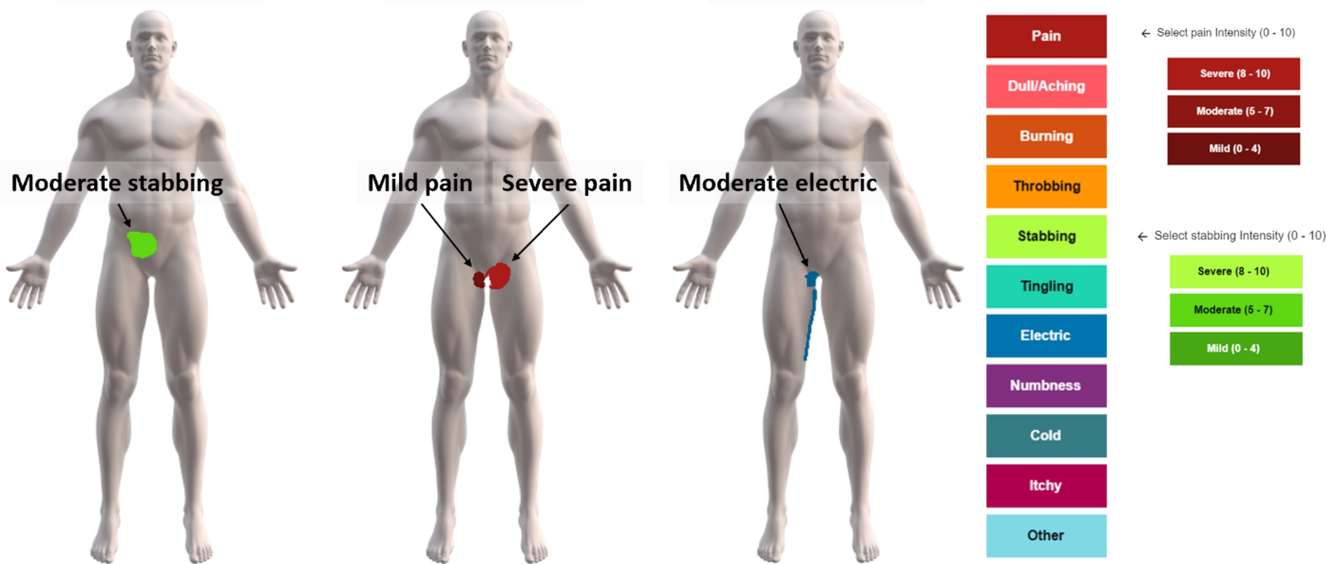 Digital body mapping of pain quality and distribution in athletes with  longstanding groin pain