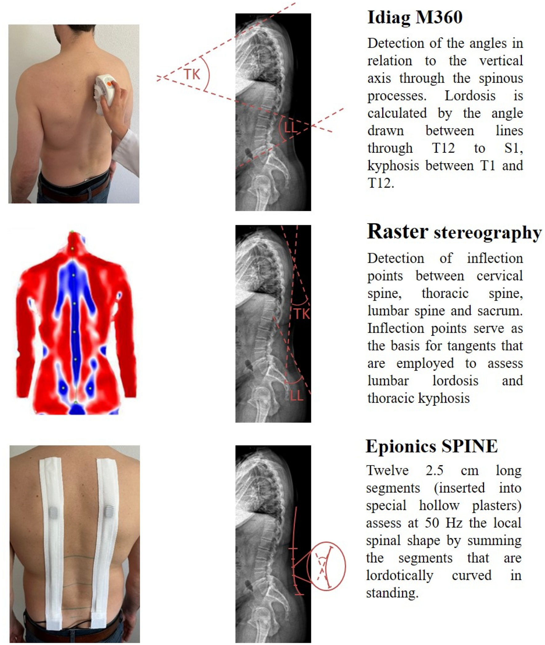 Comparison of three validated systems to analyse spinal shape and motion