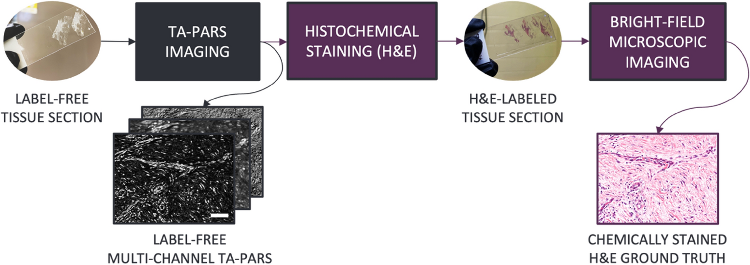 ForenScope on X: We demonstrated the performance of urine stain