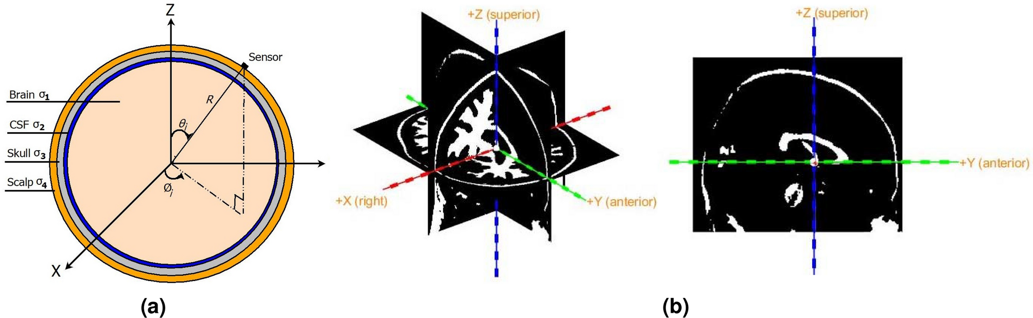 Anatomical harmonics basis based brain source localization with application  to epilepsy | Scientific Reports