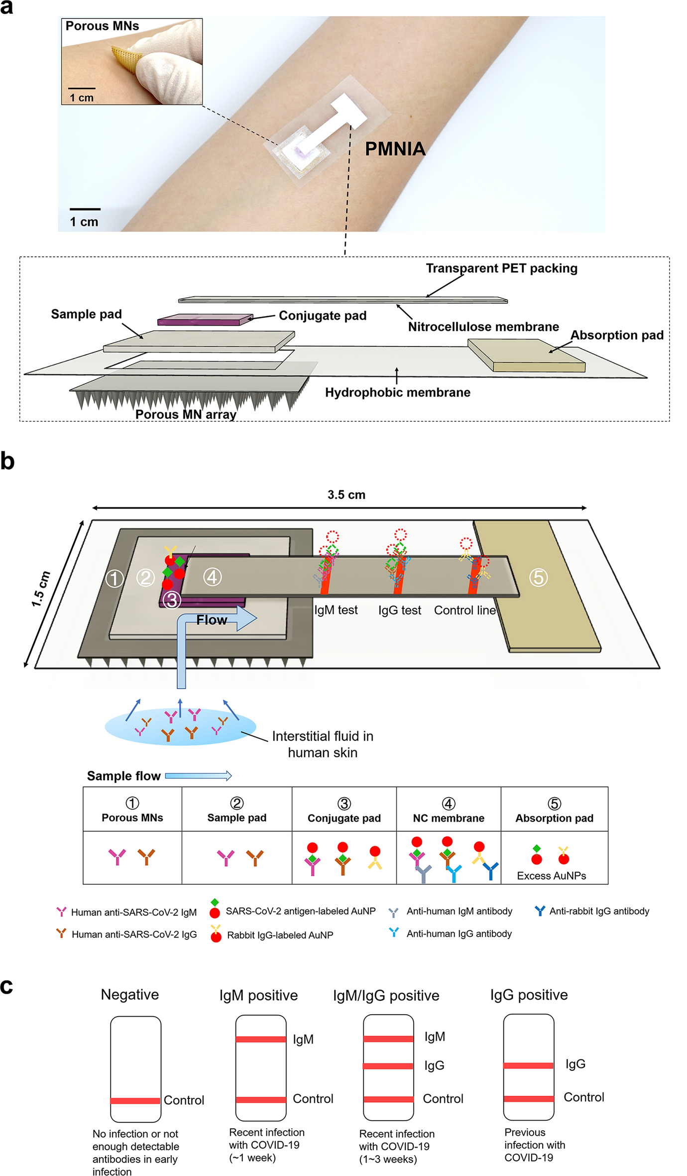 Anti-SARS-CoV-2 IgM/IgG antibodies detection using a patch sensor  containing porous microneedles and a paper-based immunoassay | Scientific  Reports