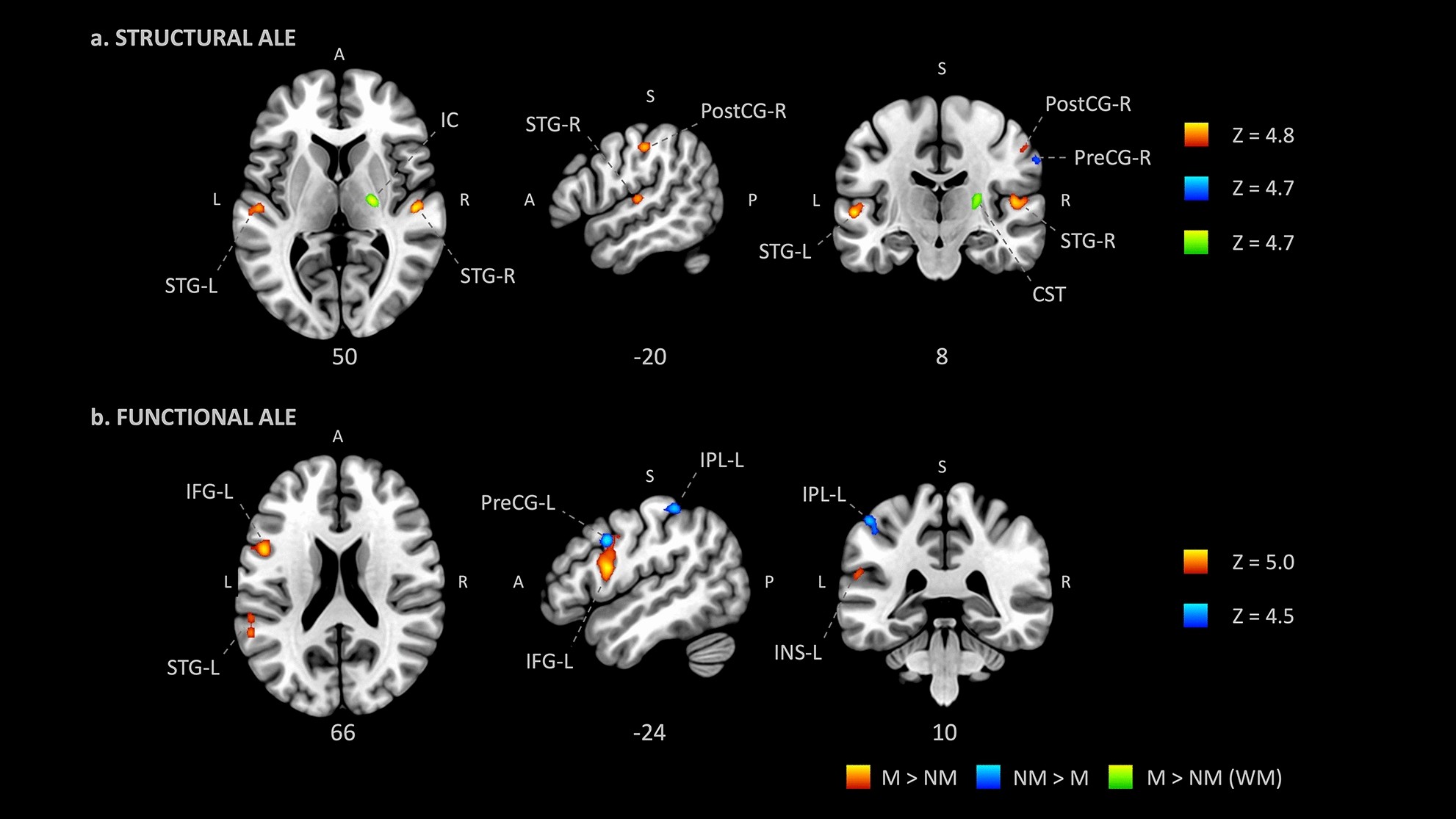 An ALE meta-analytic review of musical expertise | Scientific Reports