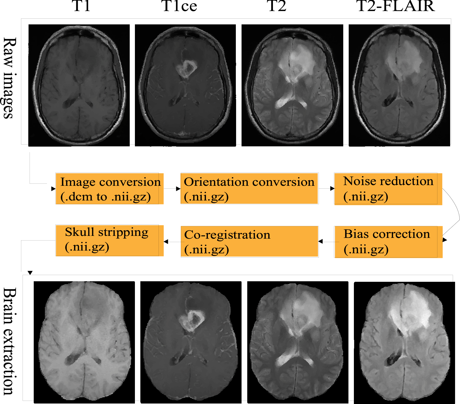 The test database of MR brain images and corresponding results for the