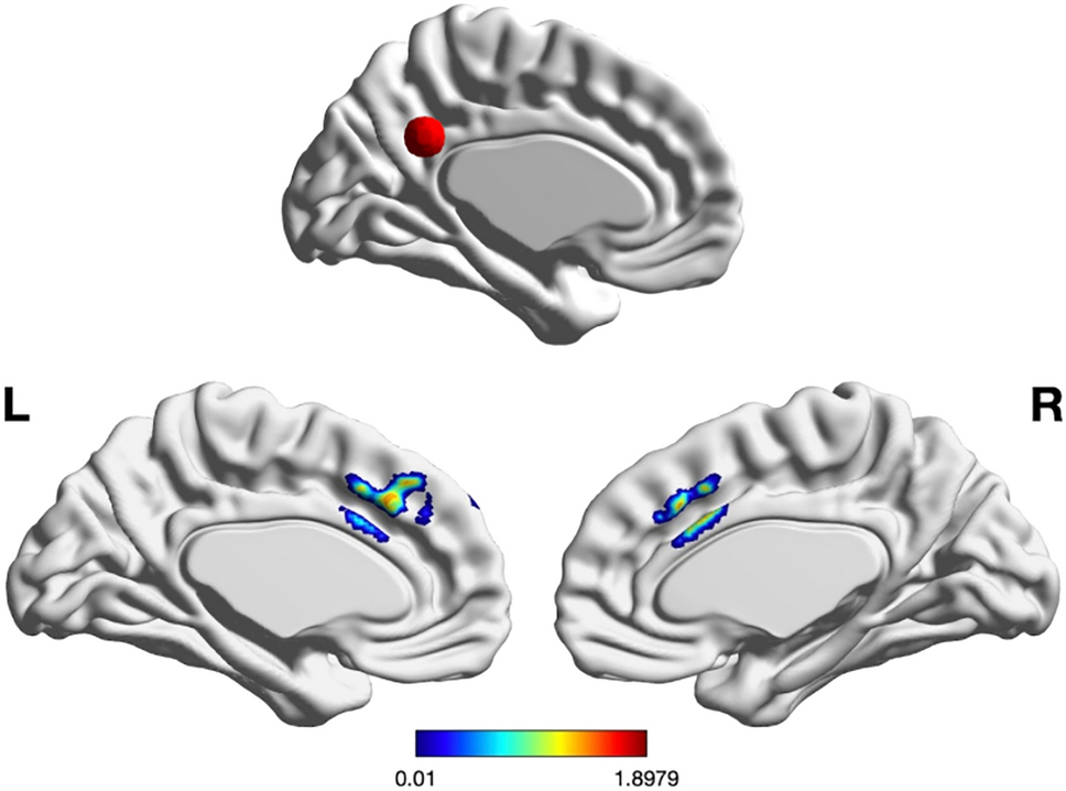 evidence mindfulness training alters state default mode network connectivity Scientific Reports