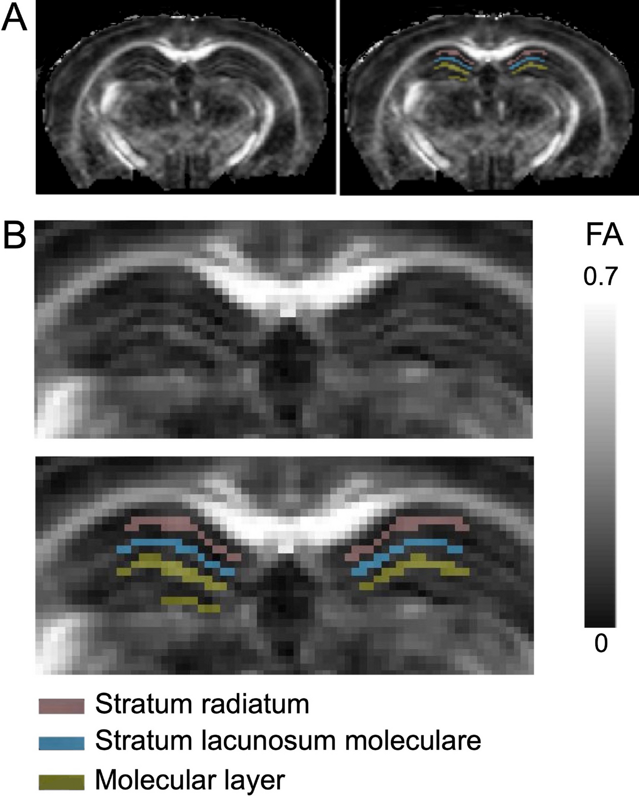 High B-value diffusion tensor imaging for early detection of hippocampal  microstructural alteration in a mouse model of multiple sclerosis |  Scientific Reports