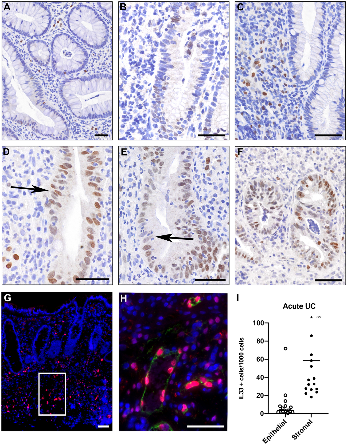 frihed Herske pin Hypo-osmotic stress induces the epithelial alarmin IL-33 in the colonic  barrier of ulcerative colitis | Scientific Reports