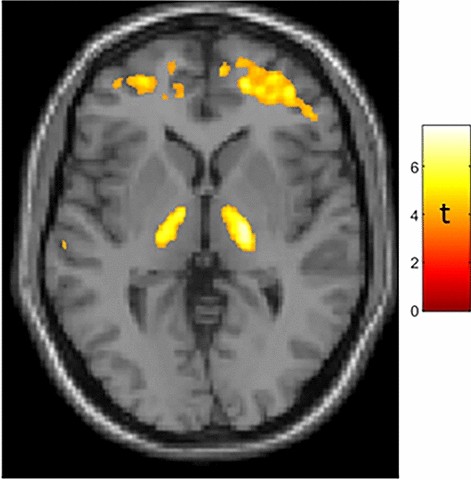Positron Emission Tomography reveals age-associated hypothalamic microglial activation in women - Scientific Reports