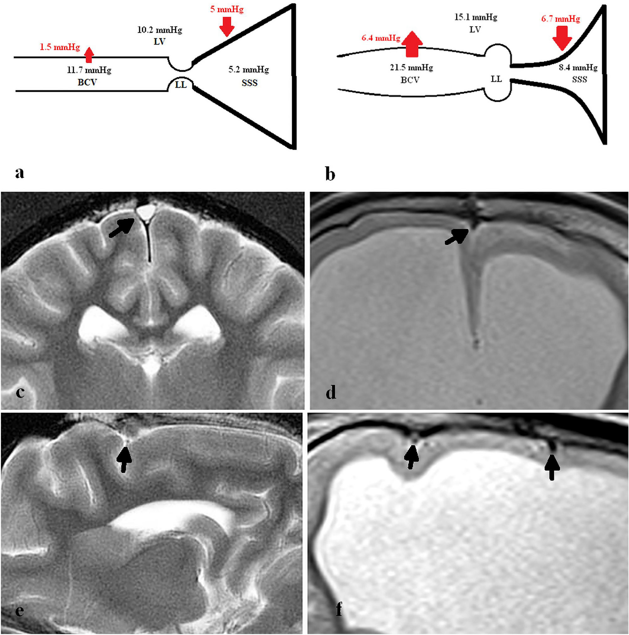 The larger superficial cerebral veins, including those draining the