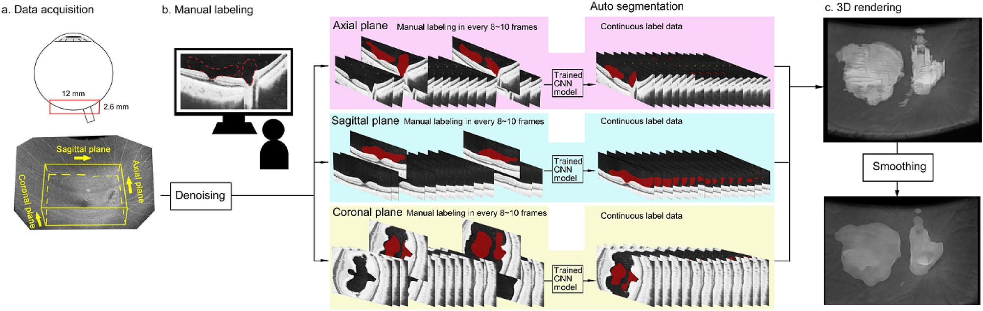 Machine learning-based 3D modeling and volumetry of human