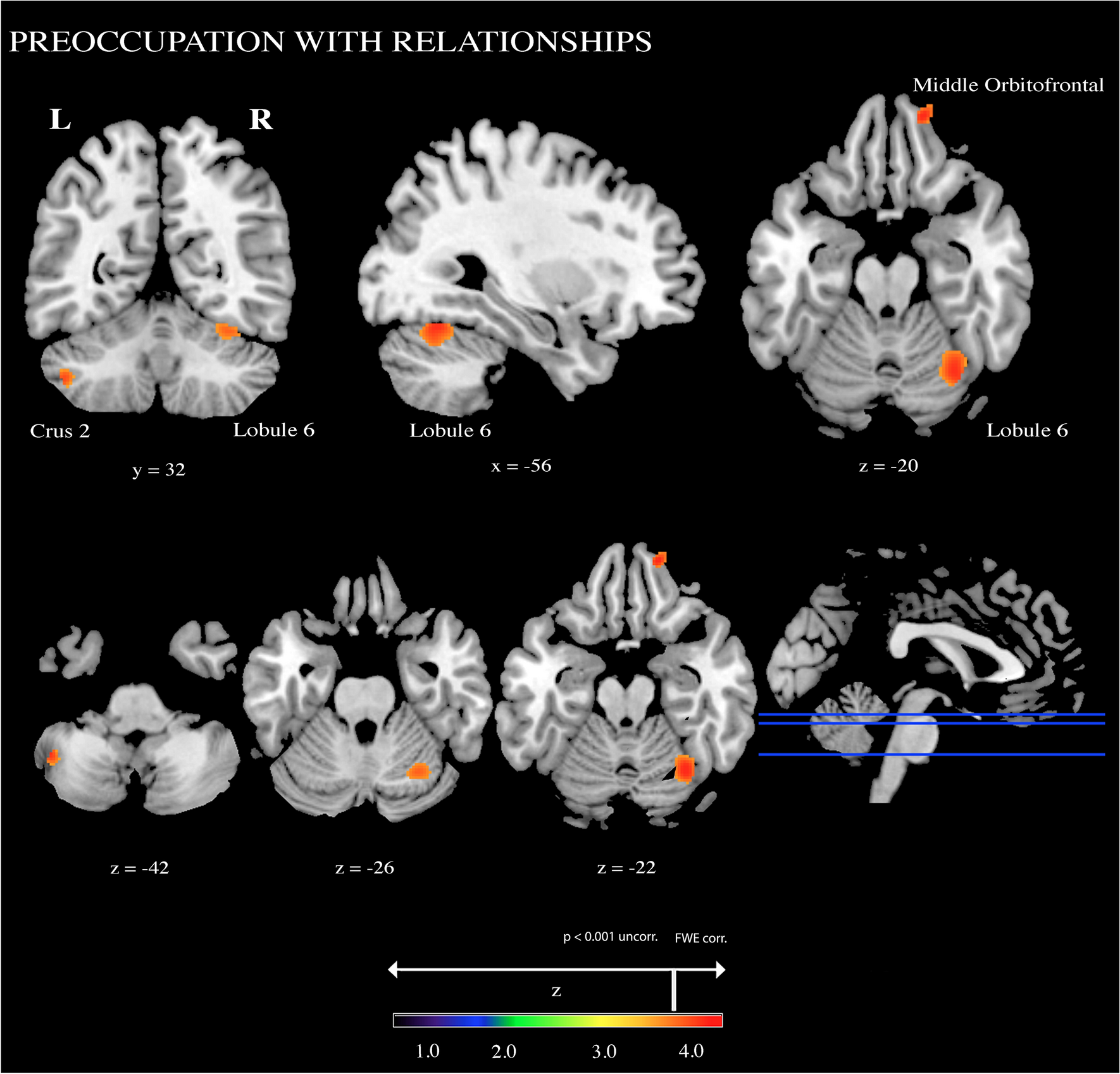 Family Closeness and Presence of Meaning Subscale Pearson r