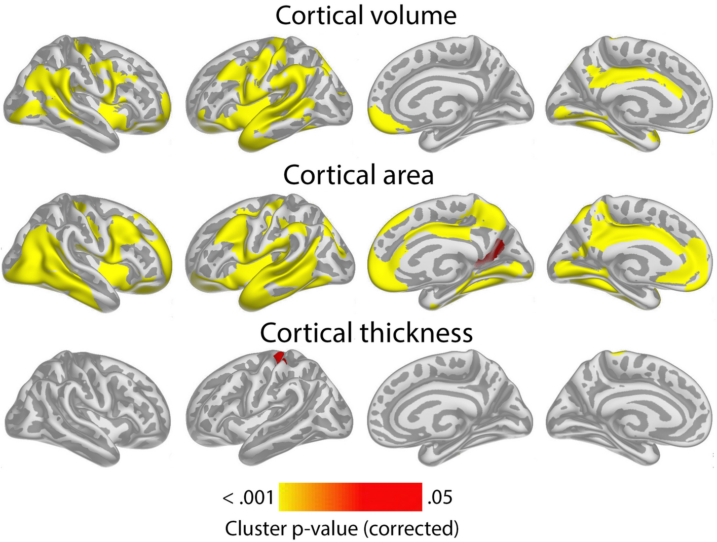 Brain and Behavior: Vol 13, No 9