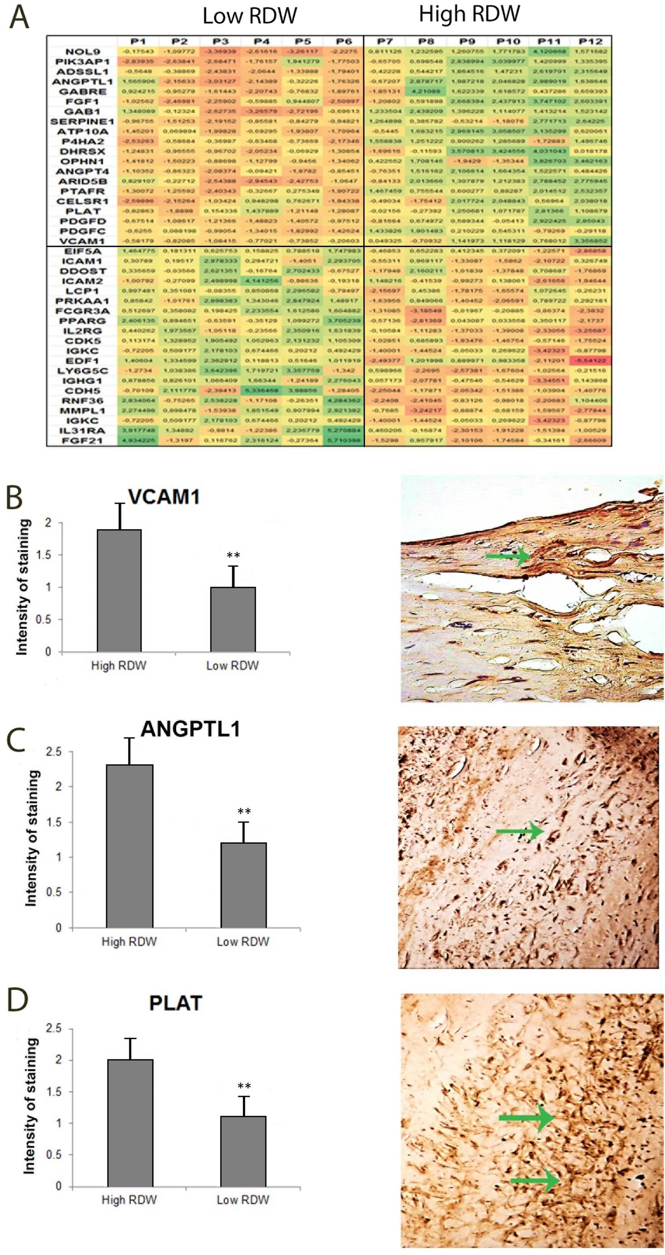 Red blood cell distribution width is associated with increased interactions of blood cells with vascular wall | Scientific Reports Red blood cell distribution width is associated with increased interactions of blood cells with vascular wall | Scientific Reports