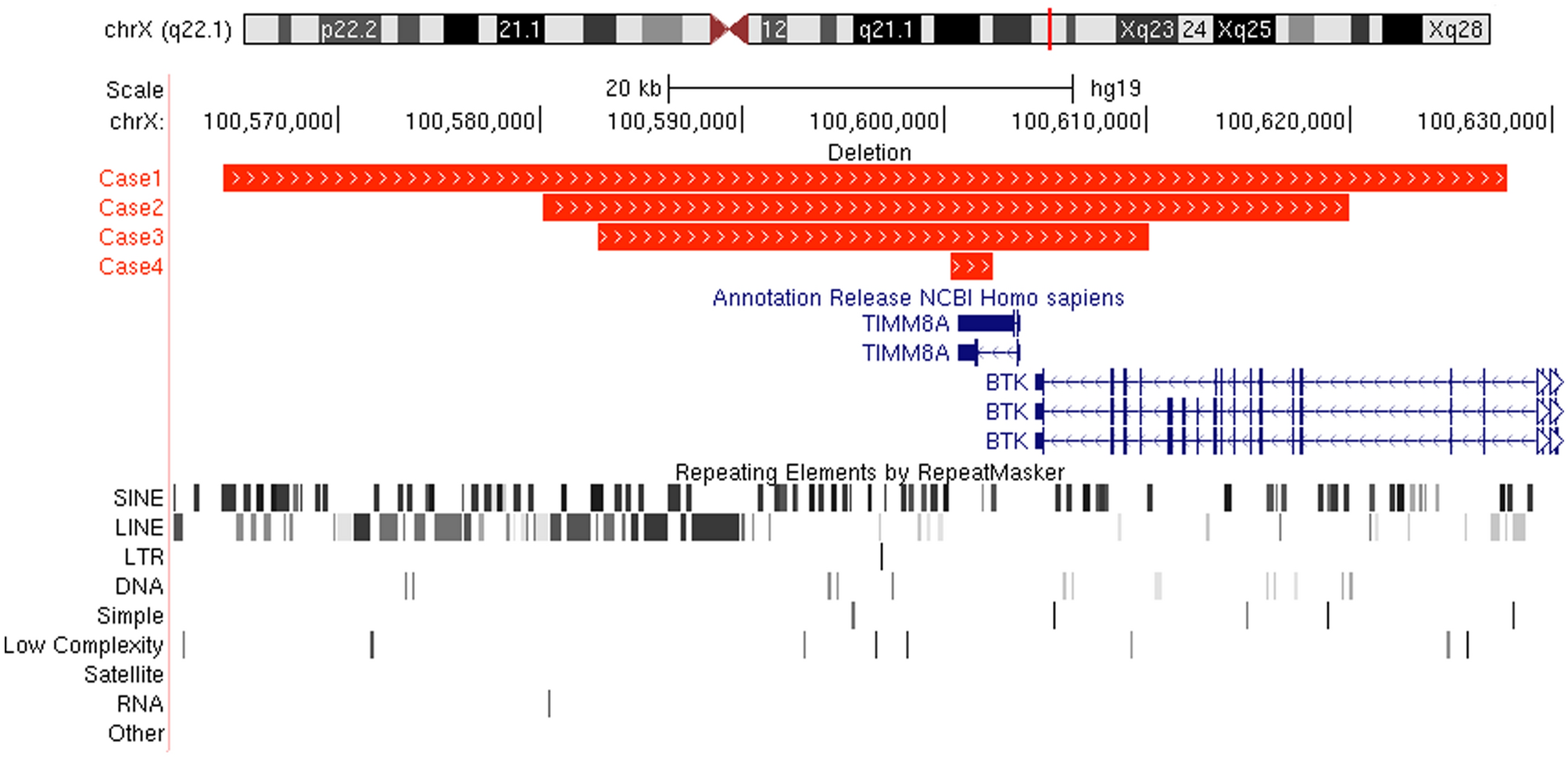 Identification and analysis of deletion breakpoints in four Mohr-Tranebjærg  syndrome (MTS) patients | Scientific Reports
