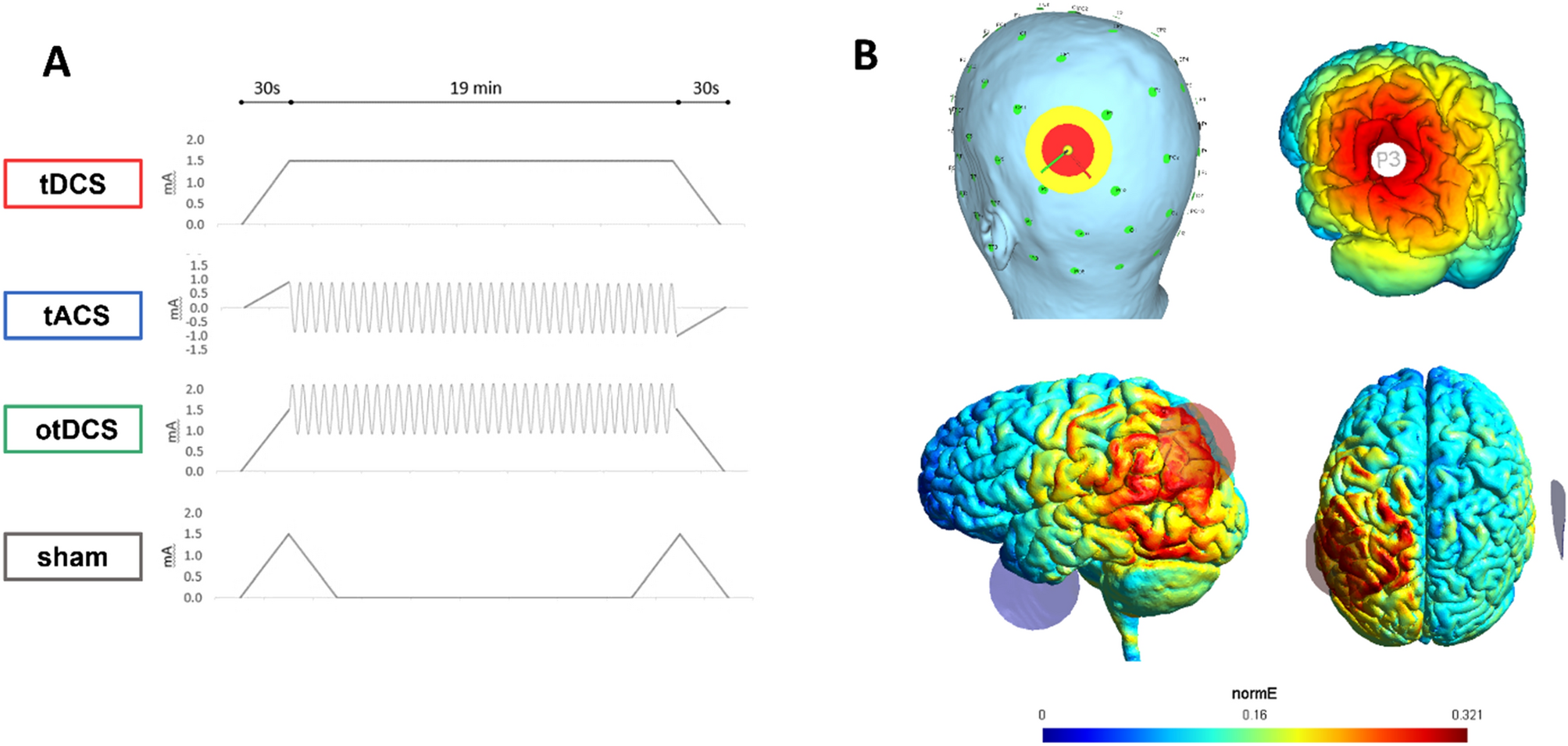 Your Brain on tACS: Electrical Stimulation Can Alleviate Chronic Back Pain  - Science in the News