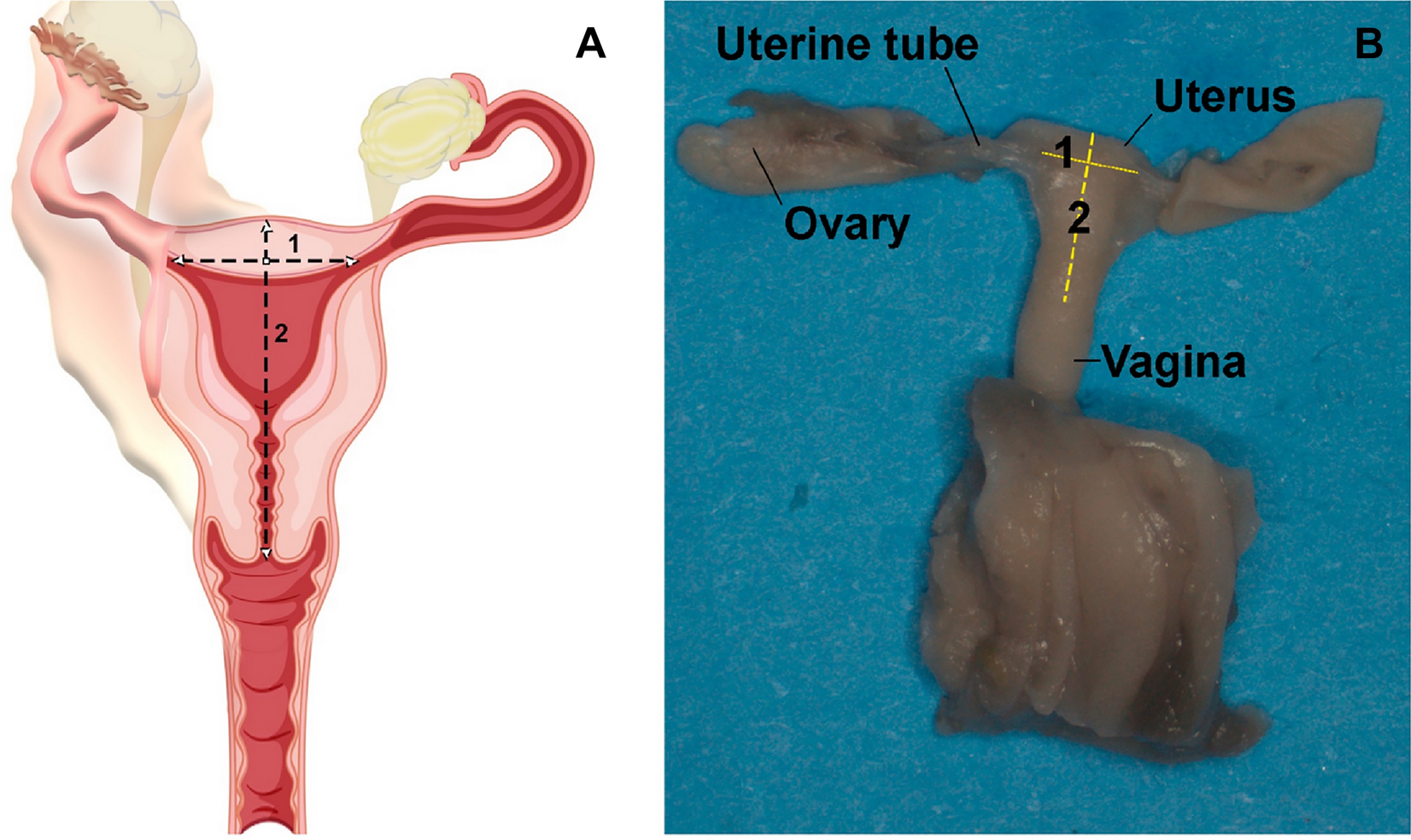 uterus 