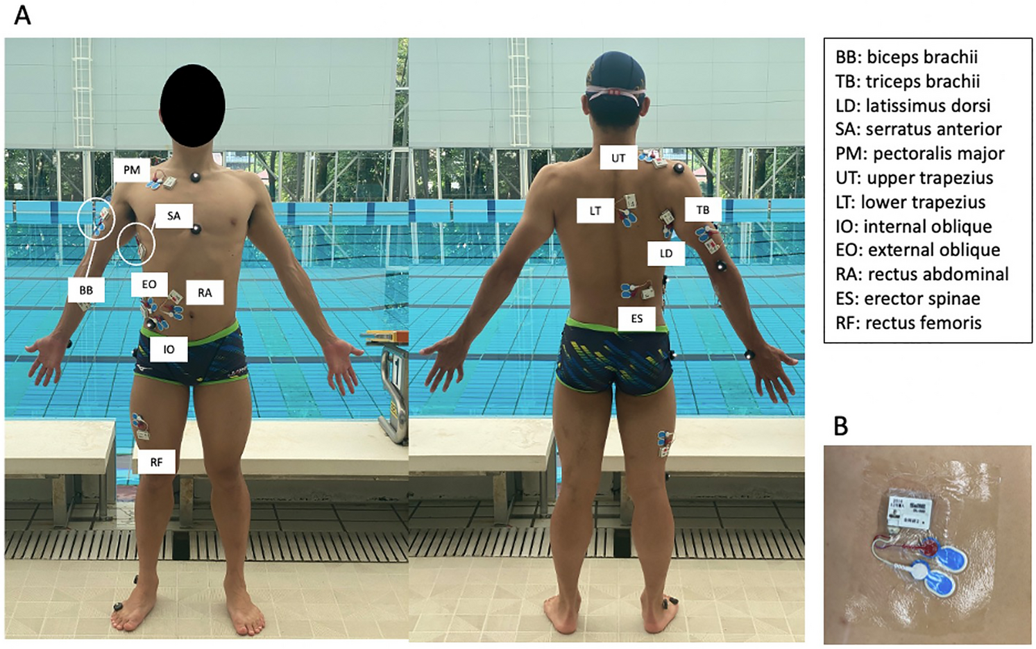 Difference in muscle synergies of the butterfly technique with and without swimmers shoulder Scientific Reports