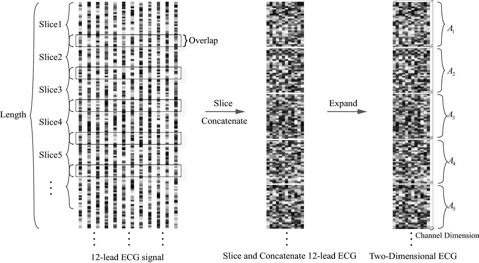 Two-dimensional ECG-based cardiac arrhythmia classification using  DSE-ResNet | Scientific Reports