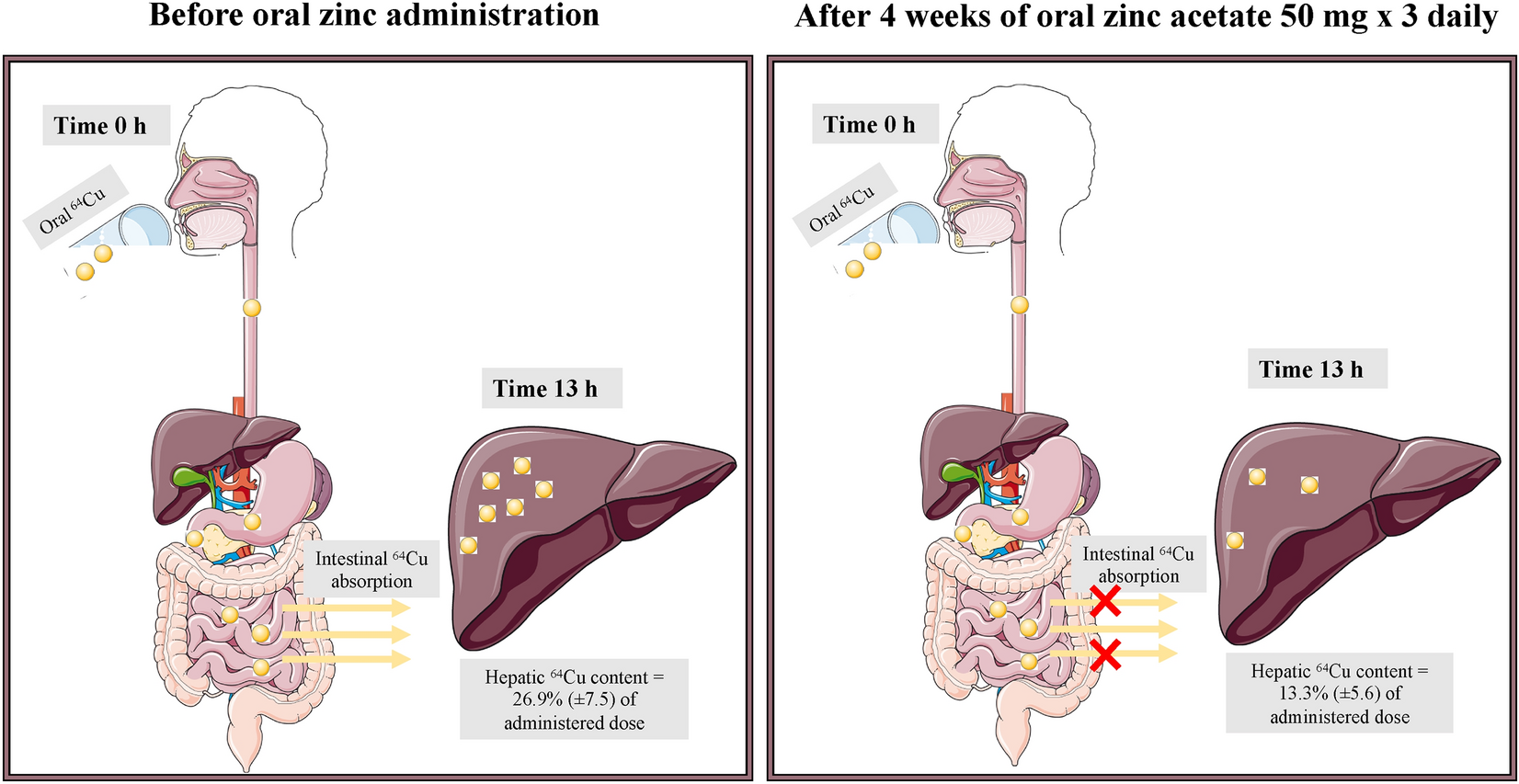 Effect of oral zinc regimens on human hepatic copper content a randomized intervention study Scientific Reports picture