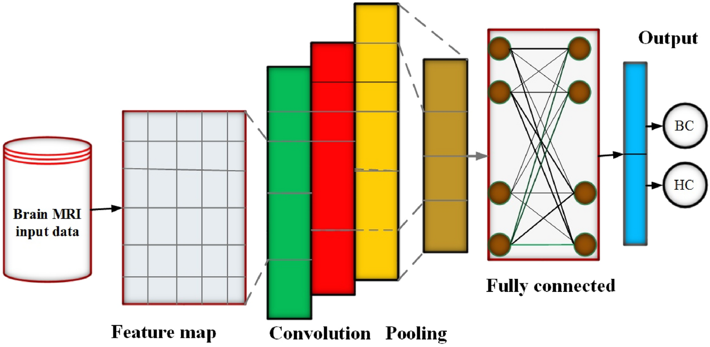 Automatic Brain Tumor Detection Using Convolutional Neural Networks