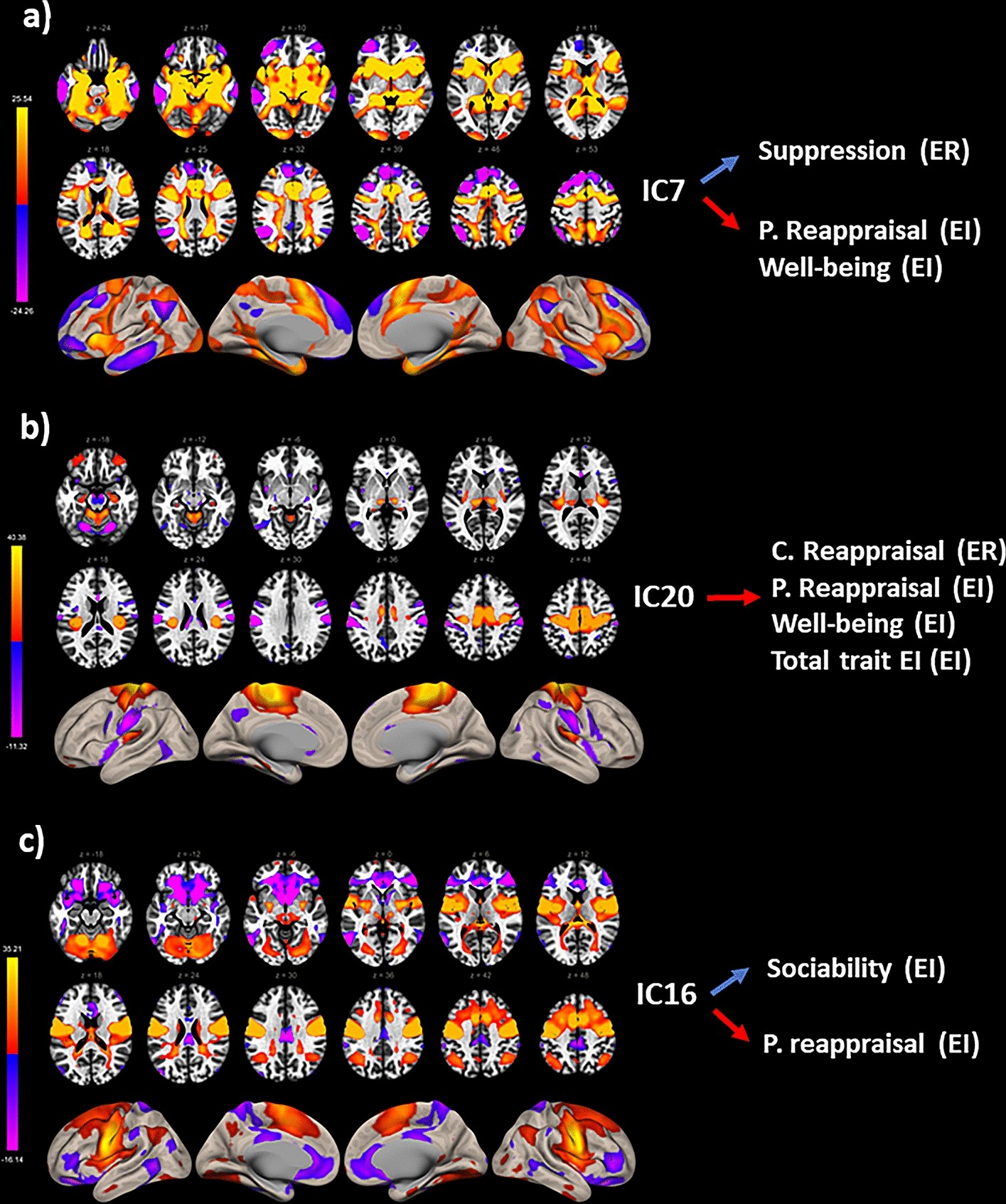 Resting-state BOLD temporal variability in sensorimotor and salience  networks underlies trait emotional intelligence and explains differences in  emotion regulation strategies | Scientific Reports