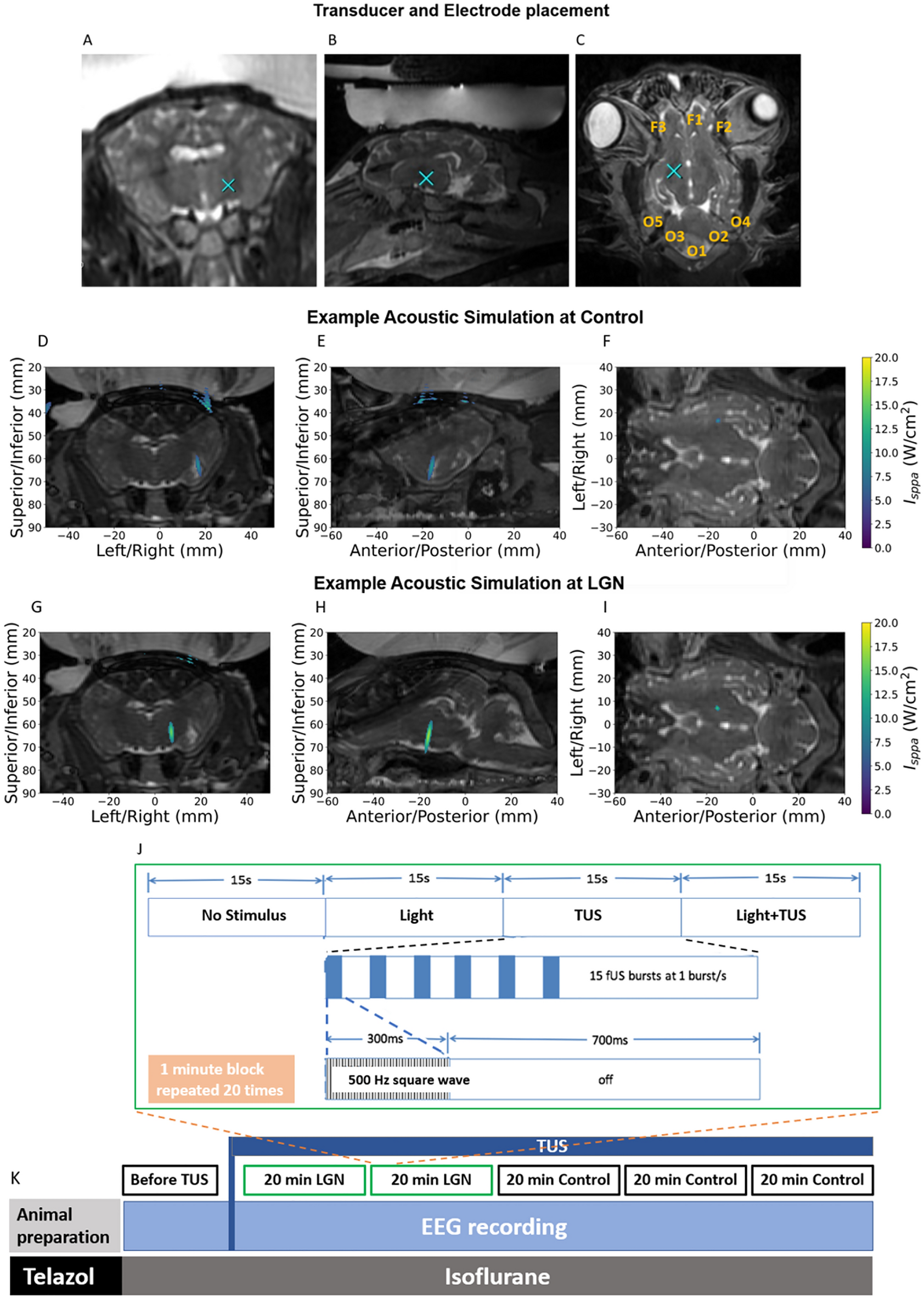 Channel spectra and map visualization of the beta band (13-30 Hz) of a