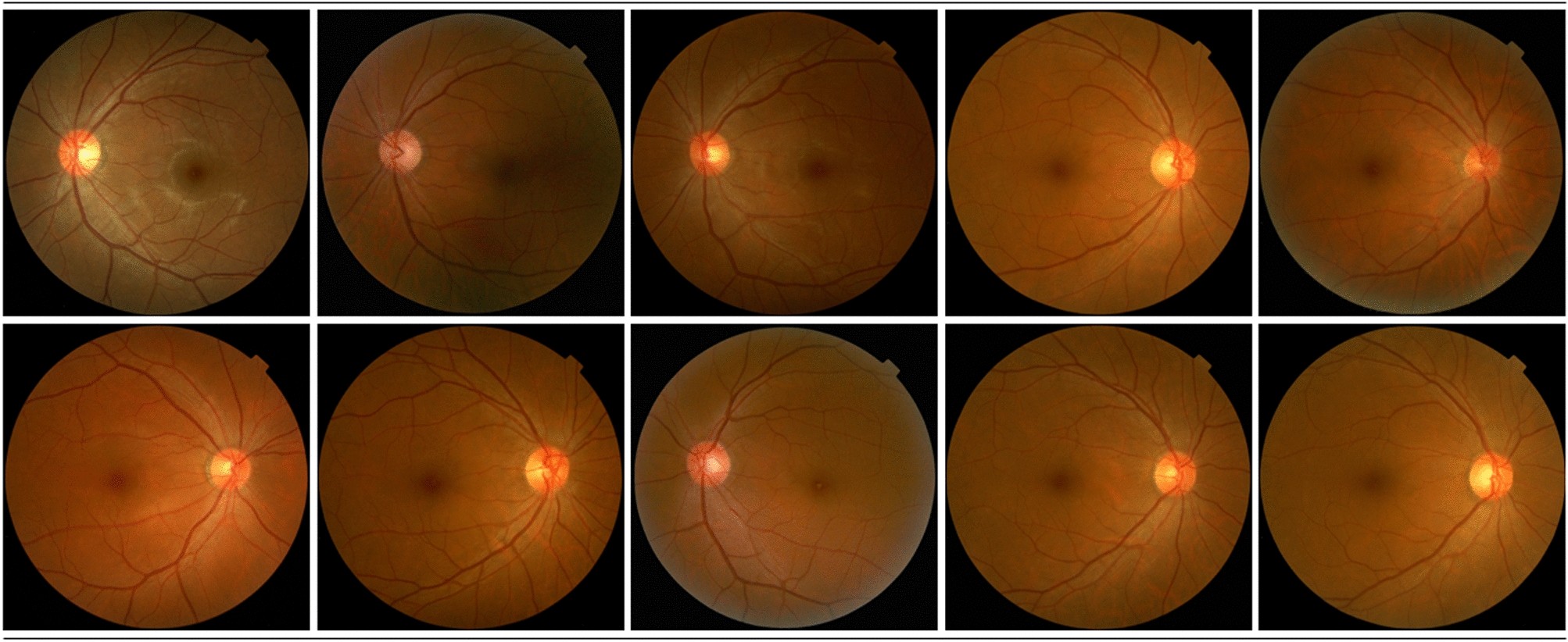 Overcoming Retinal Diseases: Can the Retina Heal Itself