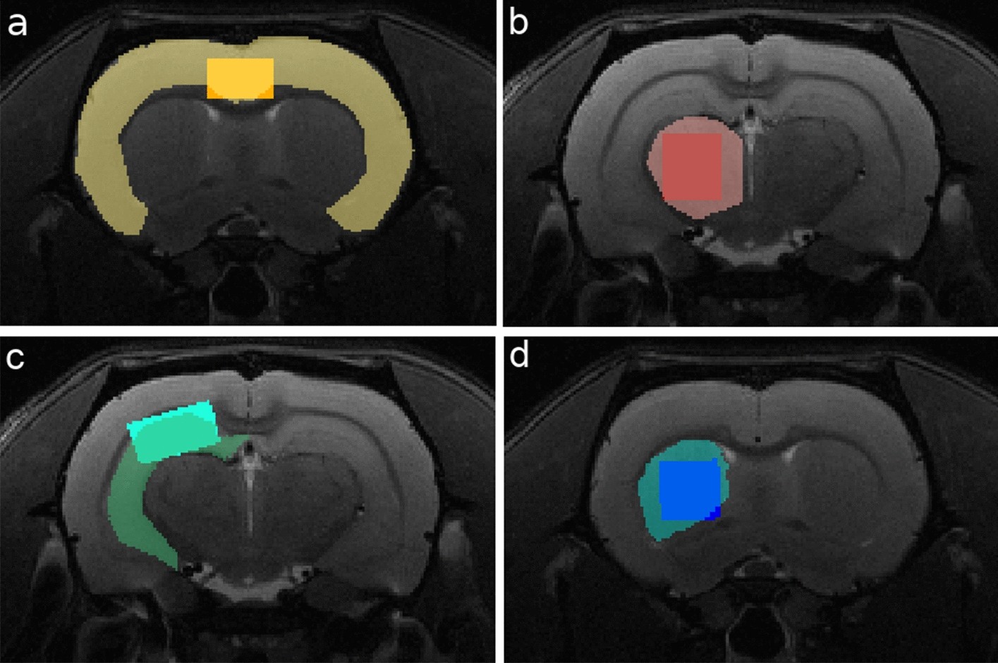 Spatio-temporal metabolic rewiring in the brain of TgF344-AD rat model of  Alzheimer's disease | Scientific Reports